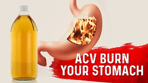 Does Apple Cider Vinegar Burn Your Stomach? – Dr.Berg