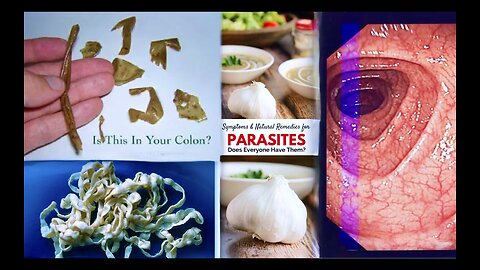 TikTok Chimerica USA Deworming How To Keep Your Colon Clean With Garlic Barbara ONeill Worm Detox