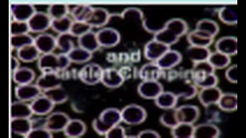 Live Blood Analysis Dark Field Microscopy explained