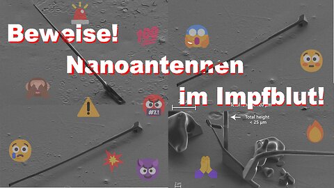 Beweise: Nanoantennen im Blut der Geimpften❗️💯🔥💥🙈😱😳🙊😈🤬😢😢😢🤡☠️☠️☠️🚨⚠️🔱