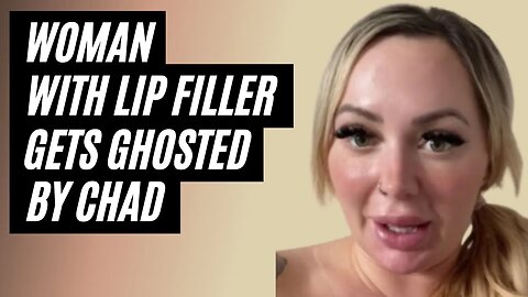 Woman With Lip Filler Gets Ghosted By Chad And Wants To Give Up Dating