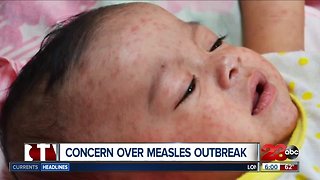 Protecting yourself from measles, outbreaks in WA and OR