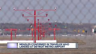 Case of measles confirmed in international traveler returning to metro Detroit on March 6