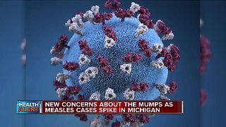 New concerns about the mumps as measles cases spike in Michigan