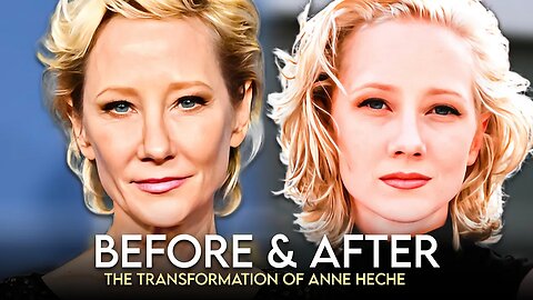 Anne Heche | Before & After | The Transformation of Her Look | IN MEMORY