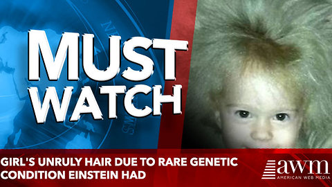 Girl's Unruly Hair Due To Rare Genetic Condition Einstein Had