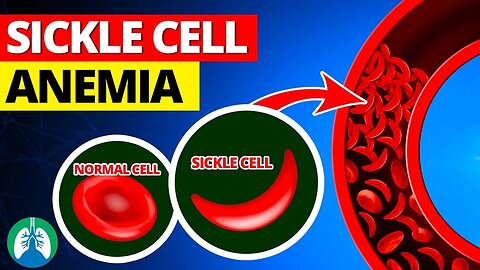 Sickle Cell Anemia *Quick Explainer Video* 🩸