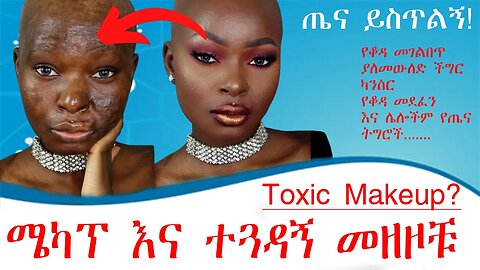 ሜካፕ እና ተጓዳኝ መዘዞቹ ጤና ይስጥልኝ | Toxic Makeup Tena Yistling Ep 1 | @exienmusicethiopia