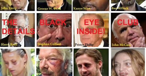 What is the Black Eye Club?