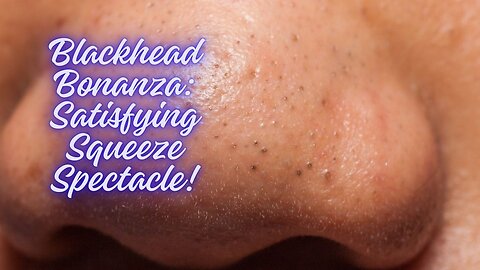 Blackhead Bonanza: Satisfying Squeeze Spectacle!