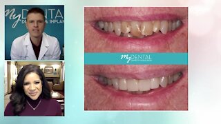 Embarrassed by your smile? Why your smile matters at My Dental Dentistry and Implants