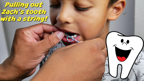 Pulling out loose tooth with a string!!!