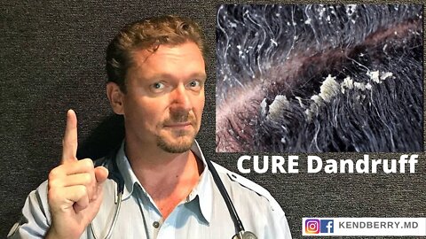 CURE Dandruff (And keep it Gone FOREVER) Seborrhoeic Dermatitis