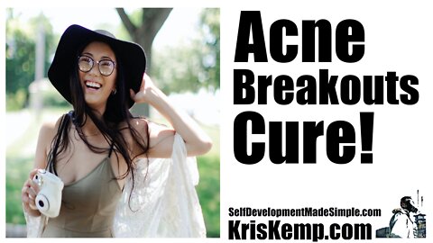 Acne breakouts Cure! You need this now! An easy cure that works!