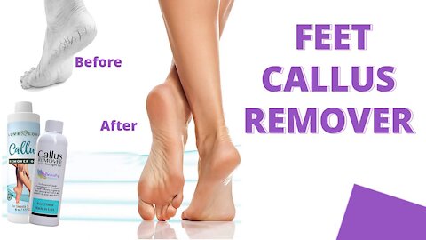 Lee Beauty Professional Callus Remover #Lee_Beauty_Professional_Callus_Remover