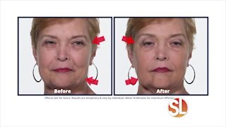 Get rid of undereye bags and wrinkles in 10-minutes with Plexaderm