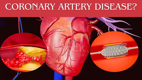 Coronary artery disease in hindi | heart attack |