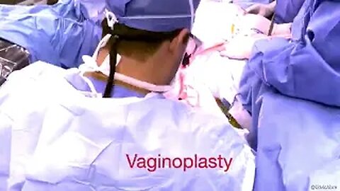 Vaginoplasty