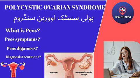 Health Nest /PCOS /polycystic ovarian syndrome/PCOS symptoms? PCOS diagnosis?PCOS treatment?