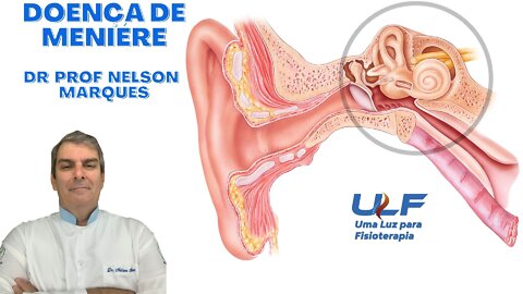 DOENÇA DE MENIÉRE - Dr. Prof. Nelson Marques
