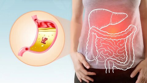 ENZIMAS DIGESTIVAS: 6 RAZÕES SURPREENDENTES PARA TOMAR