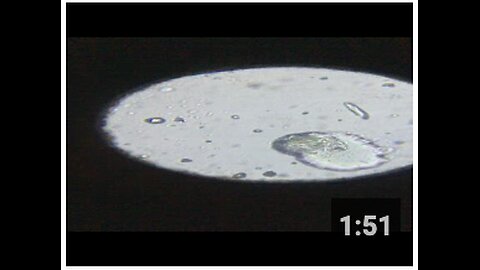 Synthetic biology lipid nanoparticle. This came out of my skin! (Part 2)