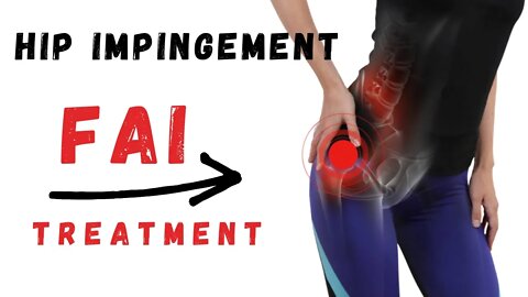 Femoroacetabular Impingement Syndrome FAI hip impingement treatment for pain relief