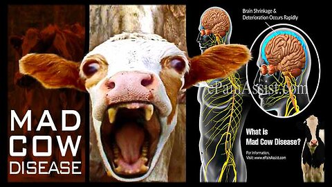 Update on 'Turbo' CJD (Mad Cow Disease In Humans ) and More Bioweapon 'Vaccine' Murder