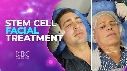 The best stem cells facial treatment | Goodbye wrinkle lines