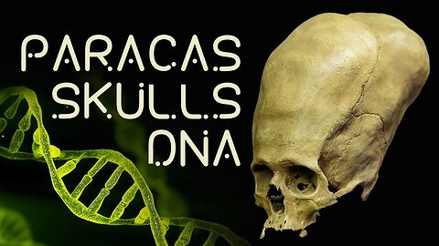 Paracas Skulls DNA, Nephilim, and Phoenicians | Timothy Alberino talks with L.A. Marzulli