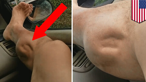 Muscle cramps explained: What’s causing this guy’s leg to spasm horrifically? - TomoNews