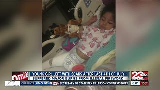 Young girl left with scars after last Fourth of July