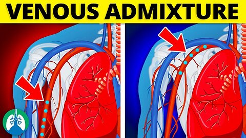 Venous Admixture (Medical Definition) | Quick Explainer Video