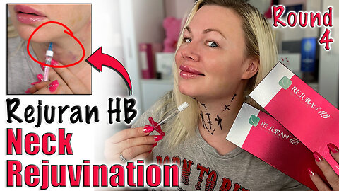 EXPENSIVE Meso - Rejuran HB Neck Rejuvination, AceCosm | Code Jessica10 saves you Money