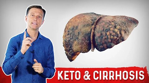 Can Keto (Ketogenic Diet) Help Cirrhosis of the Liver?