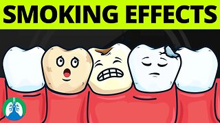 What are the Effects of Smoking on Oral Health?