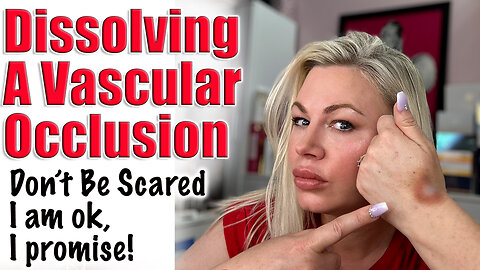 Dissolving a Vascular Occlusion, I promise I am fine :) AceCosm | Code Jessica10 Saves you money