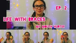 Life With Braces Ep 2: What to Eat when your Mouth Hurts!!! | Gabby’s Gallery