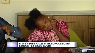 Family sues metro Detroit schools over student finger injury