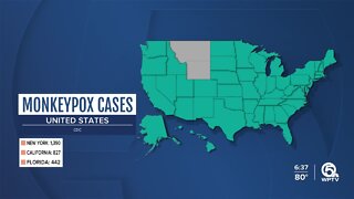 Martin County reports first two positive monkeypox cases