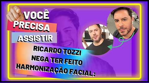 Após especulação o #ator,#RicardoTozzi,nega harmonização facial: 'A cara mudou pelo cabelo.#shorts,