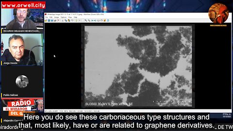 Graphene oxide detected in Sinovac (CoronaVac), AstraZeneca and Pfizer vials