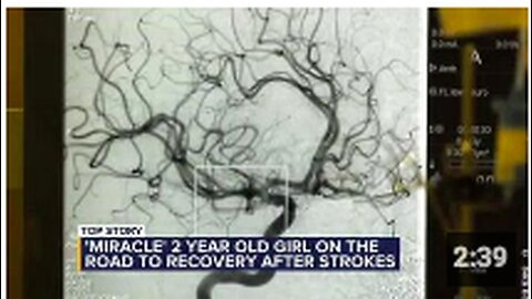 2 Year Old Struck by Multiple Strokes due to Blood Clot...