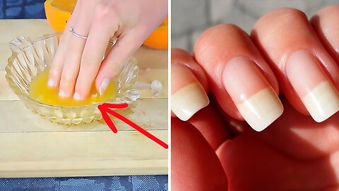 Grow Your Nails Faster With This Easy Recipe