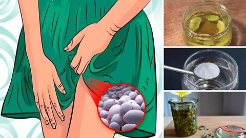 Top 8 Home Remedies for Yeast Infection (Candidiasis)