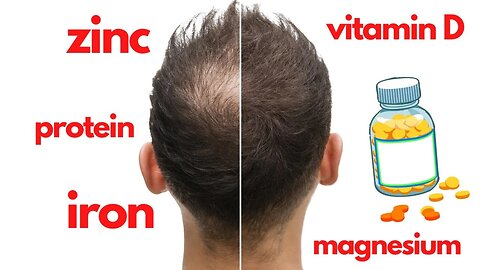 These Vitamins Make Your Hair Stop Falling Out And Grow Back Quickly