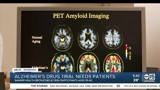 Alzheimer's drug trial needs patients