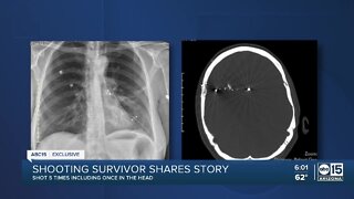 Valley woman shares story after being shot 5 times