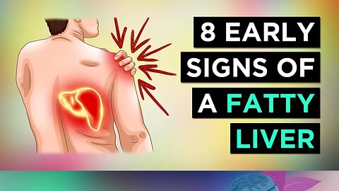 8 Signs You Have A FATTY LIVER