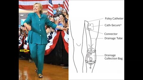 'Hillary Clinton Colostomy Bag Cover- up Consumes US Media Giants, Puts Debates In Doubt' - 2016